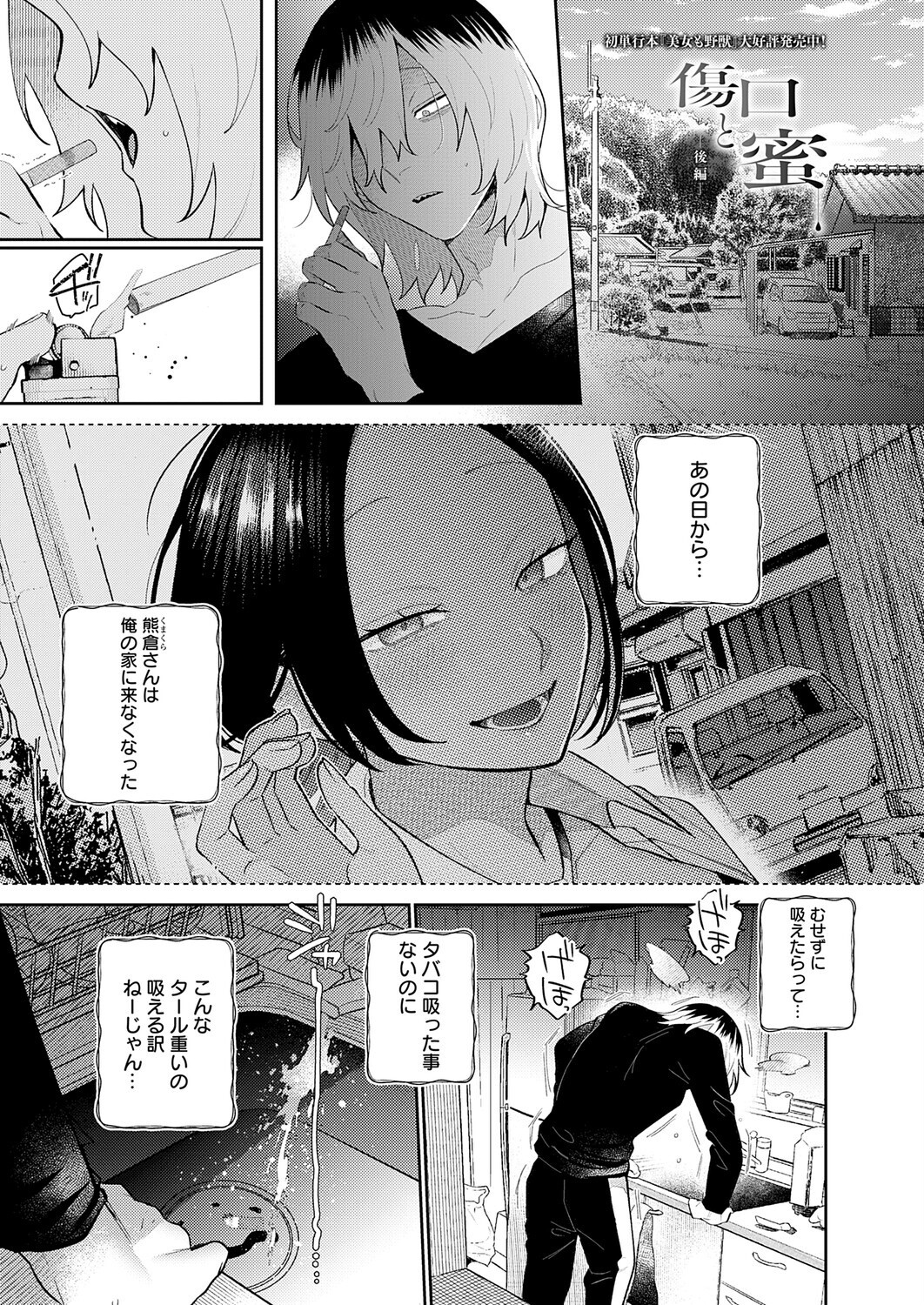 傷口と蜜＜後編＞ 画像1